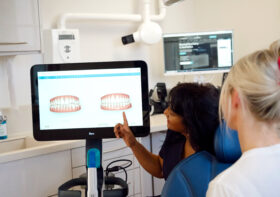 How Does Invisalign Work? | A Beginner’s Guide